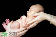 寶寶臍帶掉了要緊嗎？寶寶臍帶掉了出血了怎么辦？