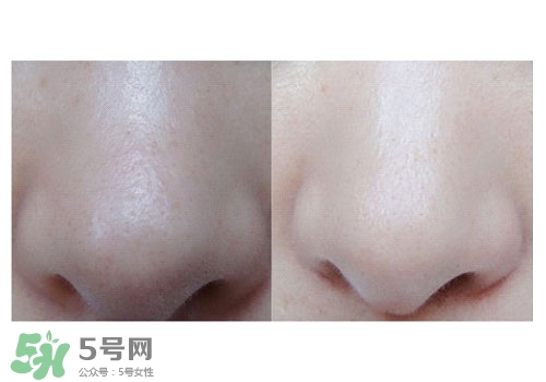 碧柔鼻貼白色和黑色哪個(gè)好？碧柔鼻貼黑白區(qū)別