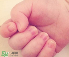 寶寶指甲凹凸不平是什么原因？寶寶指甲凹凸不平正常嗎？