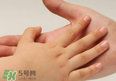 寶寶指甲凹凸不平是什么原因？寶寶指甲凹凸不平正常嗎？