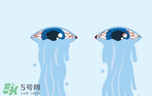 眼藥水可以兩個(gè)人用嗎？眼藥水可以共用嗎？