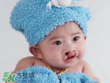 兔唇可以治嗎？兔唇修補(bǔ)術(shù)