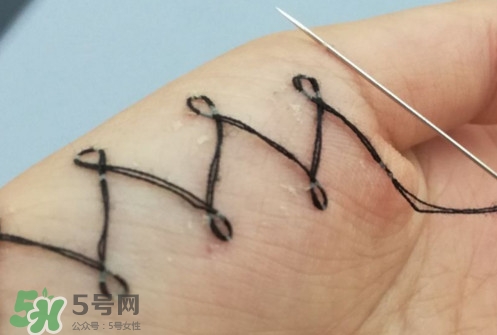人體刺繡是自殘嗎？人體刺繡有什么危害