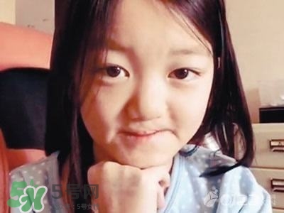 兔唇是什么？兔唇是什么原因造成的？