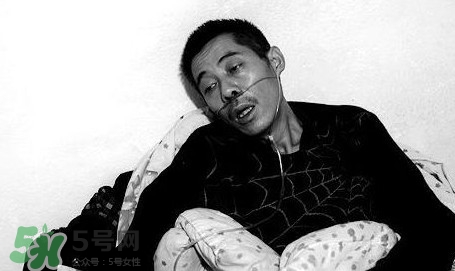 塵肺病吃什么藥能清肺？塵肺病國(guó)家有什么政策