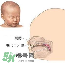 兔唇能檢查出來嗎？兔唇能完全修復嗎？