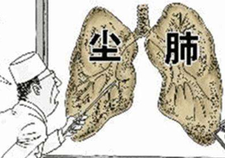 塵肺病能治愈嗎？塵肺病能活多久