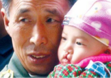 兔唇是什么？兔唇是什么原因造成的？
