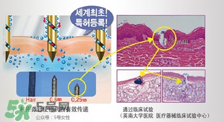 珠兒麗蚊子針好用嗎？珠兒麗蚊子針副作用