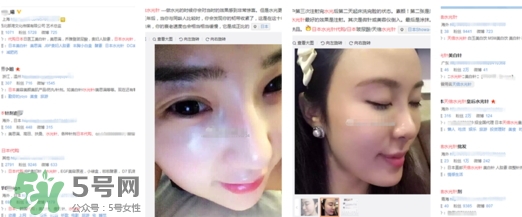 天倍面膜是日本的嗎？日本tenbe天倍面膜騙局