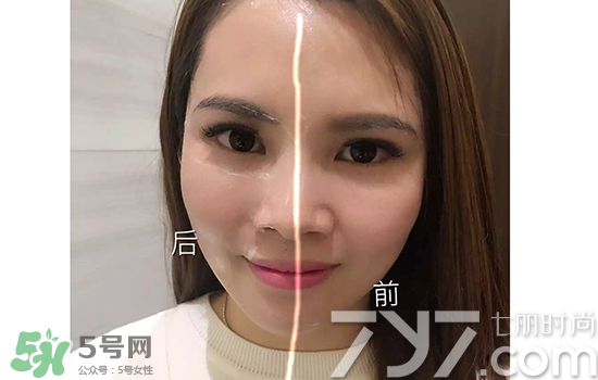 黃金棒有什么用？黃金棒的功效與作用