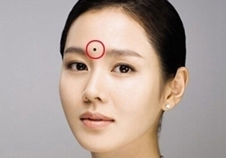 夏天可以點(diǎn)痣嗎？夏天點(diǎn)痣后要注意什么？