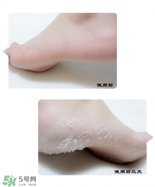 miimeow足膜多少錢(qián)?咪一喵足膜專(zhuān)柜價(jià)格
