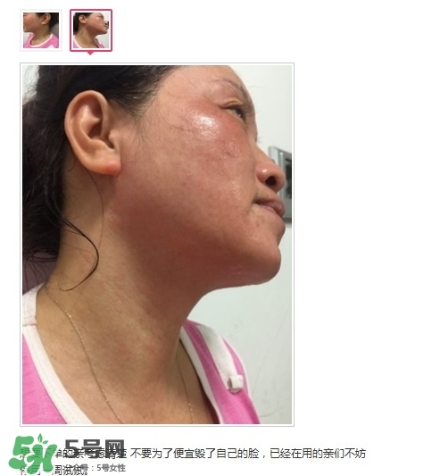 肌膚之食是什么牌子？肌膚之食讓我毀容了