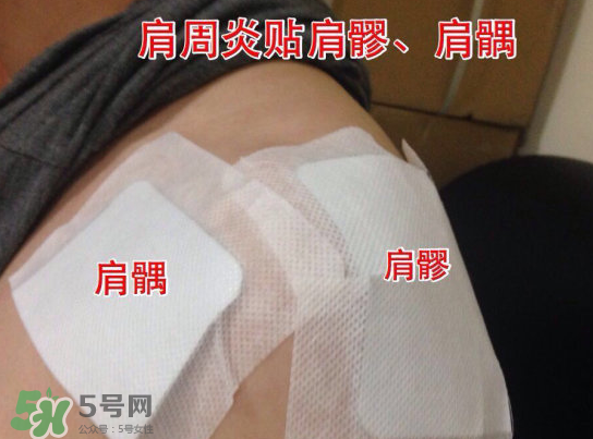 艾灸貼多少錢一盒?？艾灸貼一盒60裝多少錢？