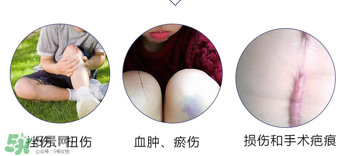 hirudoid除疤膏有效嗎？hirudoid去疤膏效果如何？
