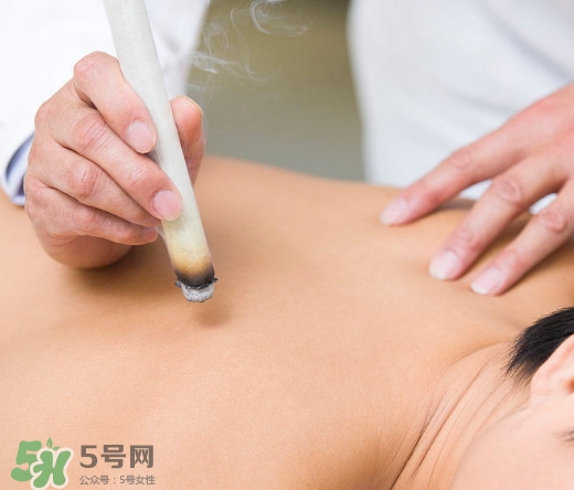 三伏貼和艾灸哪個好？三伏貼和艾灸區(qū)別