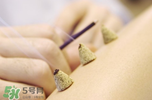 三伏貼和艾灸哪個好？三伏貼和艾灸區(qū)別