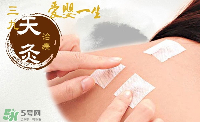 貼三伏貼可以吃魚嗎？貼三伏貼可以吃什么魚？