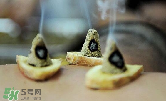 貼三伏貼可以艾灸嗎？貼三伏貼多久可以艾灸