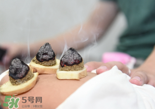 三伏灸什么人不能做？三伏灸適合哪些人？