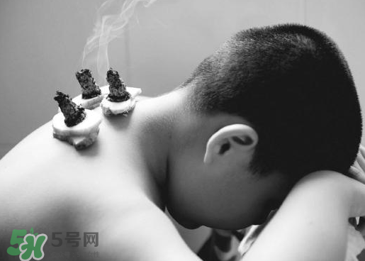 三伏灸什么人不能做？三伏灸適合哪些人？