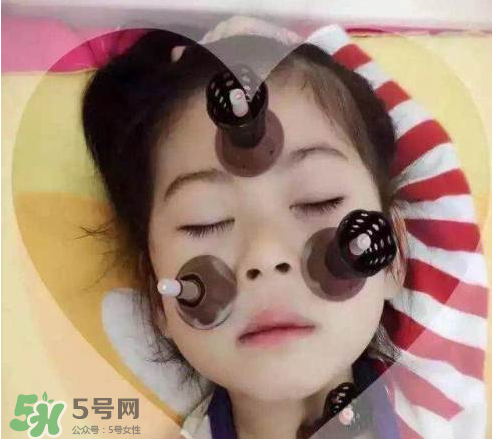 艾灸貼可以治咳嗽嗎？艾灸貼可以治退燒嗎？