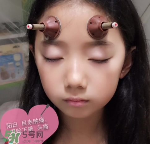 艾灸貼可以治咳嗽嗎？艾灸貼可以治退燒嗎？