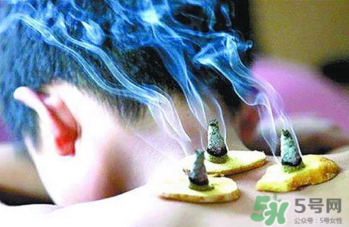 三伏灸什么時(shí)候開始灸？三伏灸怎么灸？