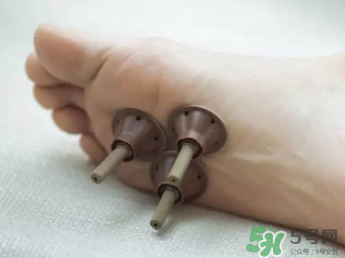 艾艾貼灸出水珠為什么？艾艾貼后有水珠要擦嗎？