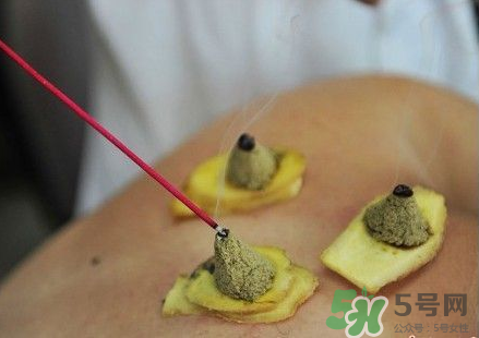三伏灸可以自己灸嗎？三伏灸可以在家做嗎？