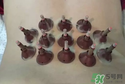 艾艾貼可以貼肚臍眼嗎？艾艾貼貼肚臍有什么作用？