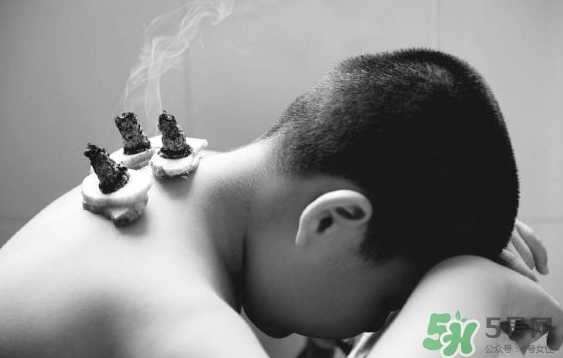 三伏灸要灸幾次？三伏灸要灸多久？