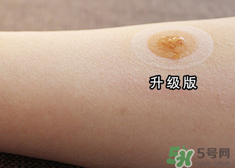 艾灸貼后有水泡怎么辦？貼艾灸貼應注意些什么？