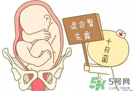 胎位不正能順產(chǎn)嗎？胎位不正怎么辦？