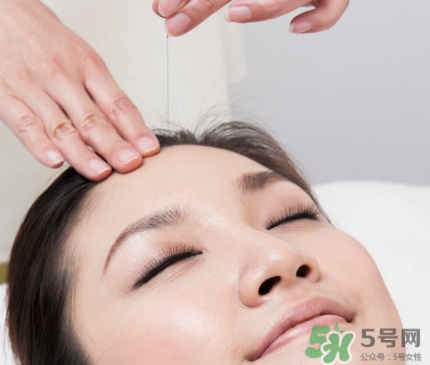 中醫(yī)院針灸一次多少錢？針灸后疼痛加重正常嗎