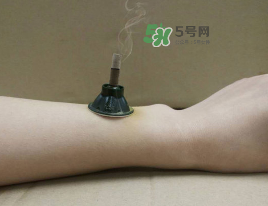 三伏天下雨可以艾灸嗎？三伏天下雨艾灸好嗎？