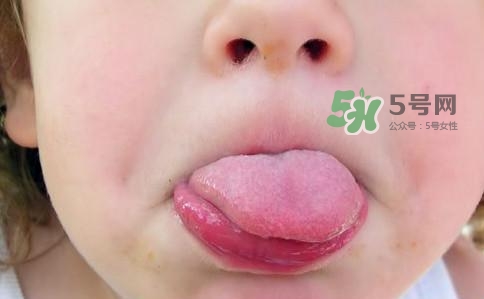 三伏天為什么濕氣重？三伏天為什么要注意祛濕？