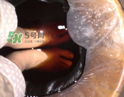 醋泡腳用白醋還是陳醋？泡腳用什么醋最好？