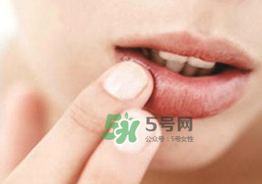 你的嘴唇為什么起泡 嘴唇上的水泡治不好嗎？