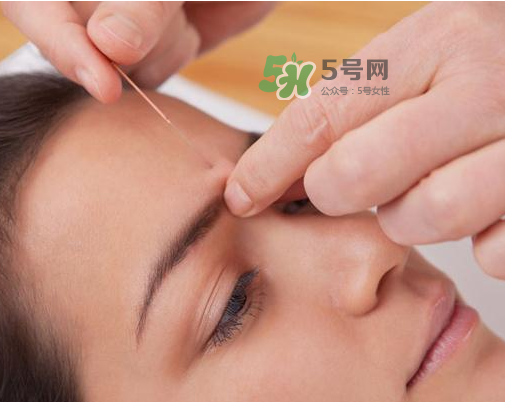 三伏天針灸有什么好處？三伏天針灸注意什么？