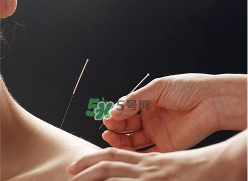 三伏天針灸有什么好處？三伏天針灸注意什么？