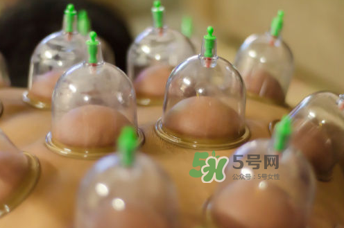 拔火罐是夏天好還是冬天好？什么時(shí)候拔火罐最合適？