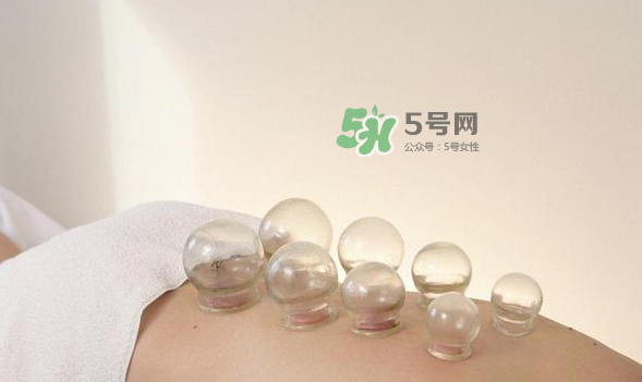 拔火罐是夏天好還是冬天好？什么時(shí)候拔火罐最合適？