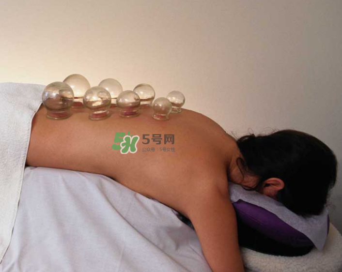 拔火罐一次多長時間？拔火罐一般多長時間？