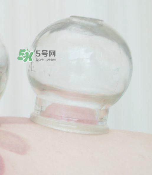 拔火罐一次多長時間？拔火罐一般多長時間？