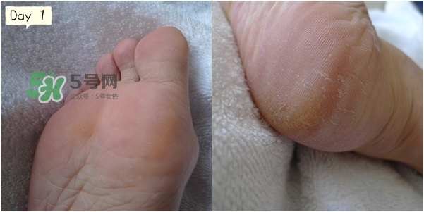 baby foot足膜怎么用？baby foot足膜使用方法