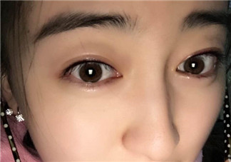 做美瞳線會不會掉睫毛？做美瞳線掉睫毛怎么辦？
