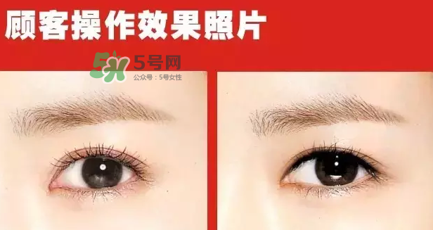 美瞳線有必要做嗎？做美瞳線多少錢？