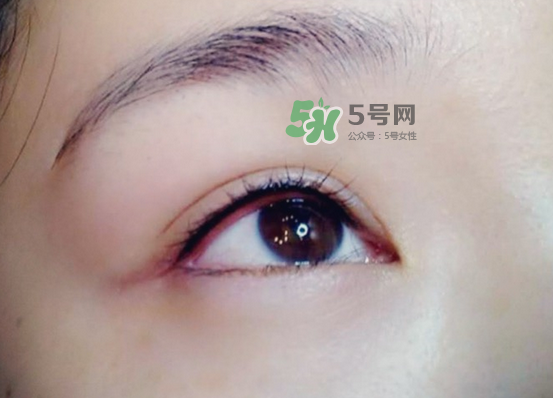 做美瞳線疼嗎？做美瞳線后要注意什么？